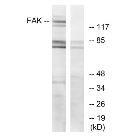 Western Blot - Anti-FAK Antibody (B7083) - Antibodies.com