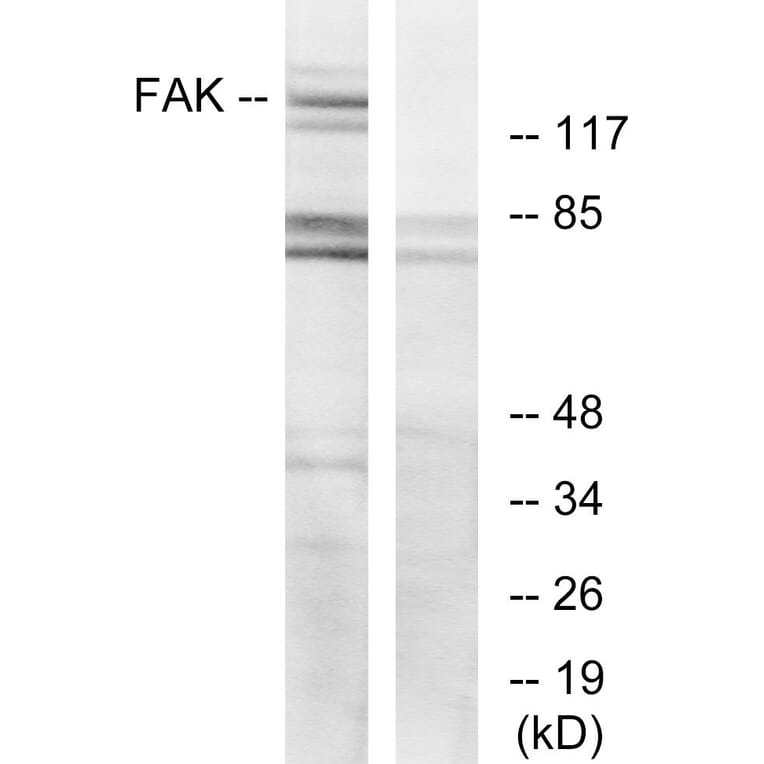 Western Blot - Anti-FAK Antibody (B7083) - Antibodies.com