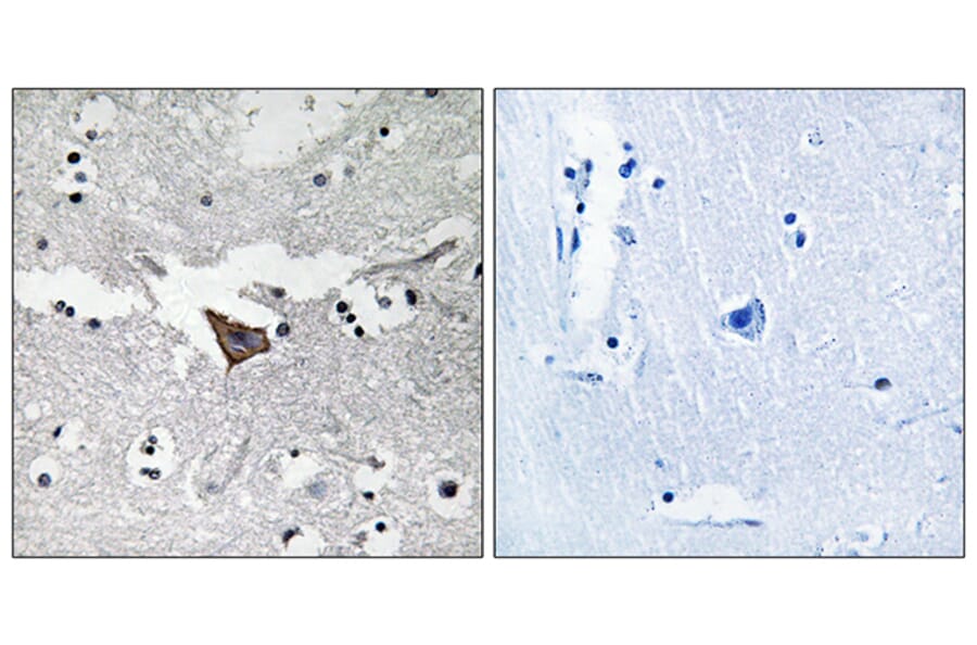 Immunohistochemistry - Anti-FAK Antibody (B7083) - Antibodies.com