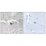 Immunohistochemistry - Anti-FAK Antibody (B7083) - Antibodies.com