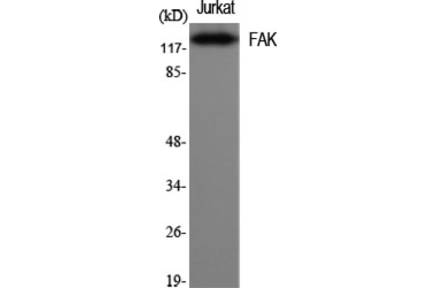Western Blot - Anti-FAK Antibody (B7083) - Antibodies.com