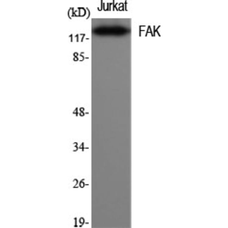 Western Blot - Anti-FAK Antibody (B7083) - Antibodies.com