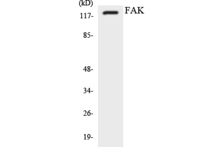 Western Blot - Anti-FAK Antibody (R12-2762) - Antibodies.com