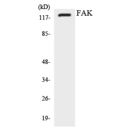 Western Blot - Anti-FAK Antibody (R12-2762) - Antibodies.com