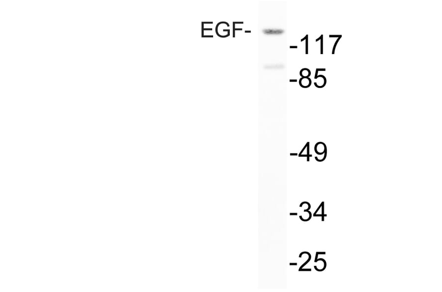 Western Blot - Anti-EGF Antibody (R12-2126) - Antibodies.com