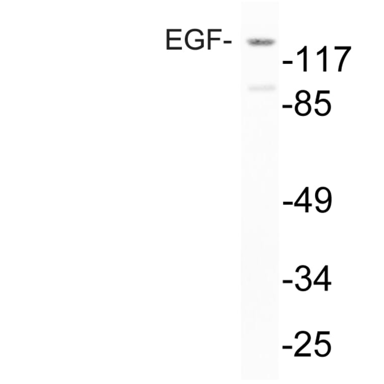 Western Blot - Anti-EGF Antibody (R12-2126) - Antibodies.com
