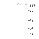 Western Blot - Anti-EGF Antibody (R12-2126) - Antibodies.com