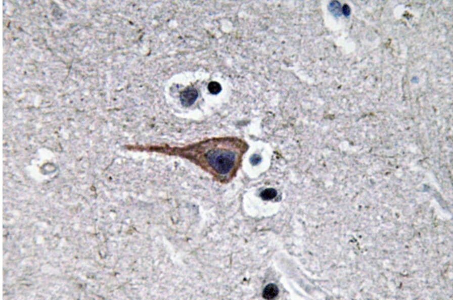 Immunohistochemistry - Anti-EGF Antibody (R12-2126) - Antibodies.com