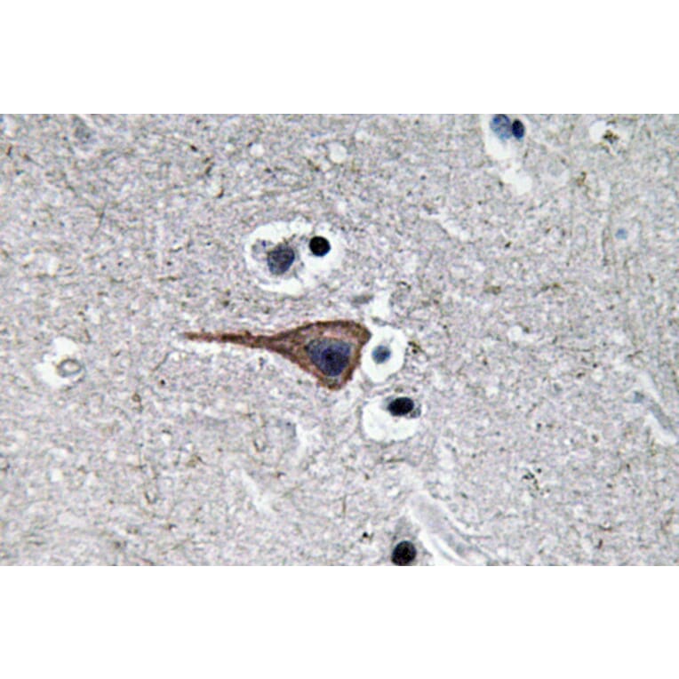 Immunohistochemistry - Anti-EGF Antibody (R12-2126) - Antibodies.com