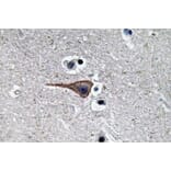 Immunohistochemistry - Anti-EGF Antibody (R12-2126) - Antibodies.com