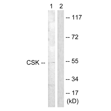 Western Blot - Anti-CSK Antibody (B0415) - Antibodies.com