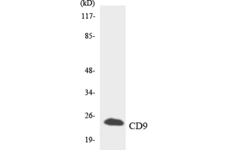 Western Blot - Anti-CD9 Antibody (R12-2593) - Antibodies.com