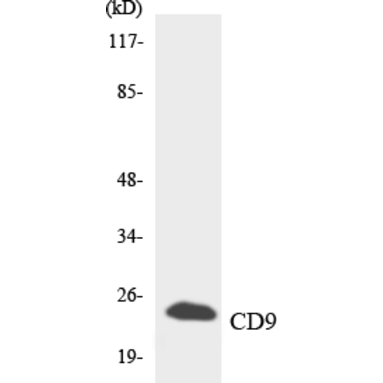 Western Blot - Anti-CD9 Antibody (R12-2593) - Antibodies.com