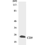 Western Blot - Anti-CD9 Antibody (R12-2593) - Antibodies.com