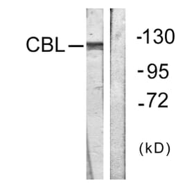 Western Blot - Anti-CBL Antibody (B0467) - Antibodies.com