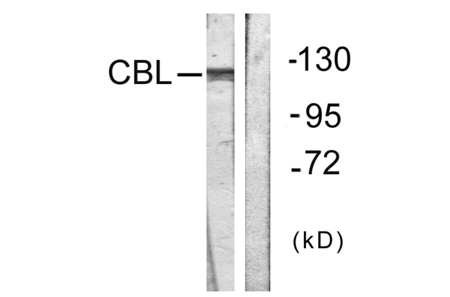 Western Blot - Anti-CBL Antibody (B0467) - Antibodies.com