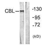 Western Blot - Anti-CBL Antibody (B0467) - Antibodies.com
