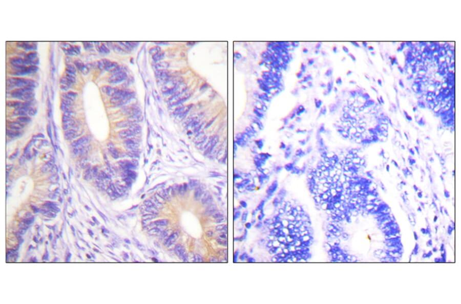 Immunohistochemistry - Anti-CBL Antibody (B0467) - Antibodies.com