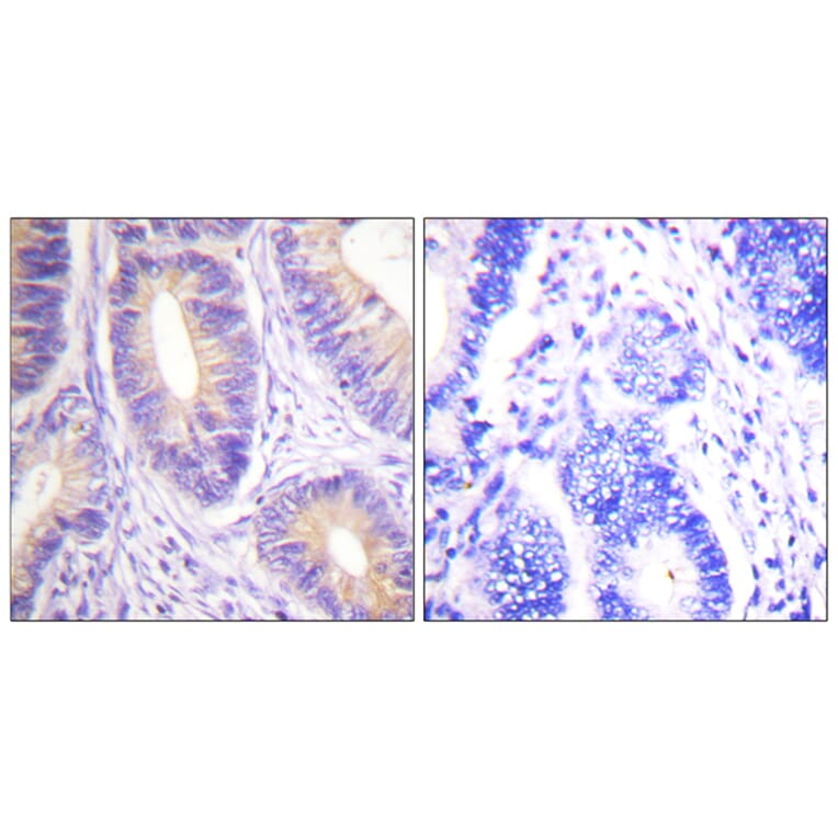 Immunohistochemistry - Anti-CBL Antibody (B0467) - Antibodies.com