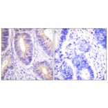 Immunohistochemistry - Anti-CBL Antibody (B0467) - Antibodies.com