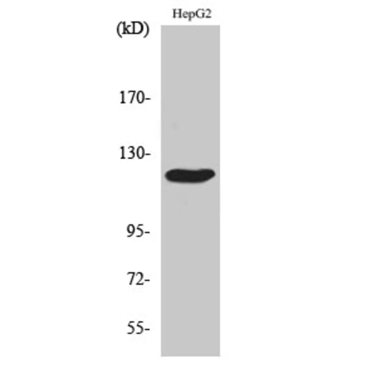 Western Blot - Anti-CBL Antibody (B0467) - Antibodies.com