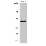 Western Blot - Anti-CBL Antibody (B0467) - Antibodies.com