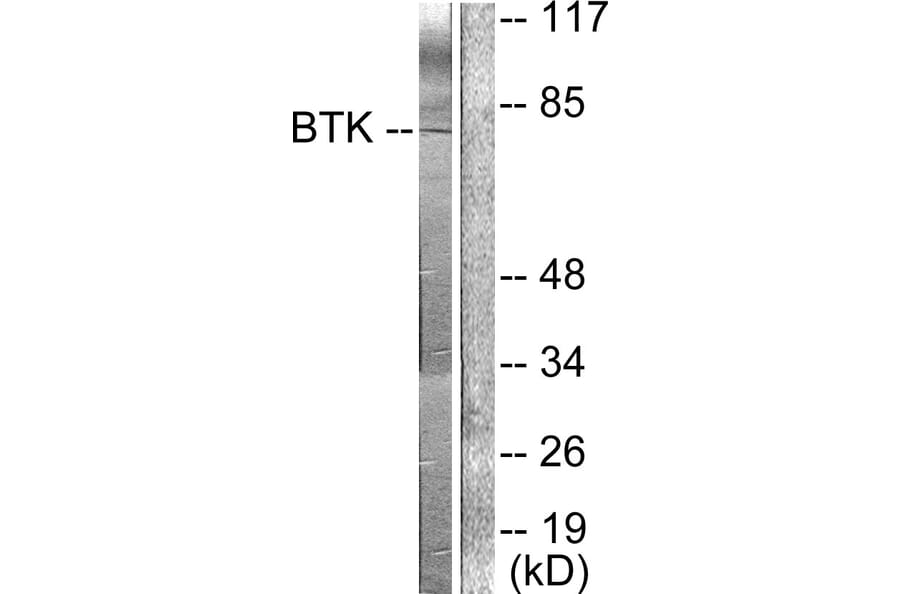 Western Blot - Anti-BTK Antibody (B0054) - Antibodies.com