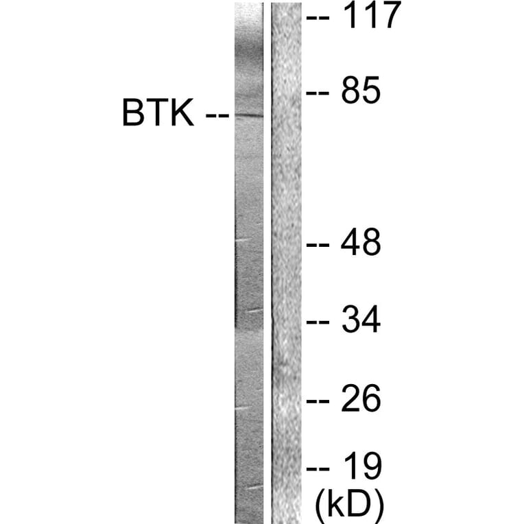 Western Blot - Anti-BTK Antibody (B0054) - Antibodies.com