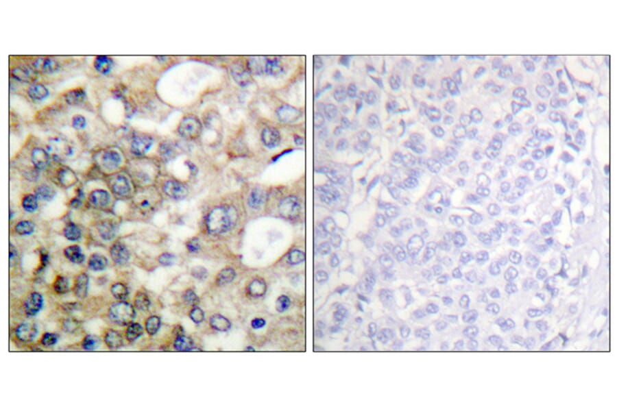Immunohistochemistry - Anti-BTK Antibody (B0054) - Antibodies.com