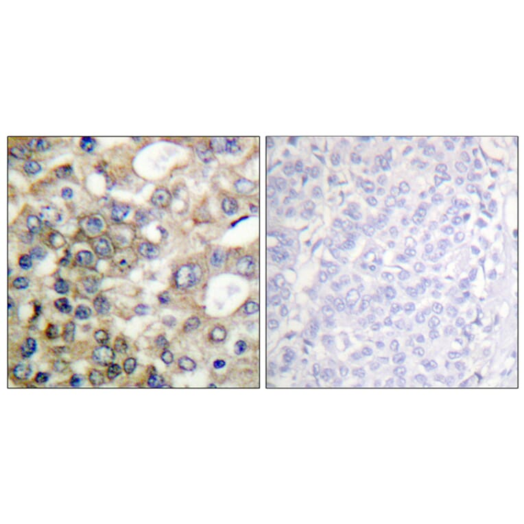 Immunohistochemistry - Anti-BTK Antibody (B0054) - Antibodies.com