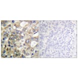 Immunohistochemistry - Anti-BTK Antibody (B0054) - Antibodies.com