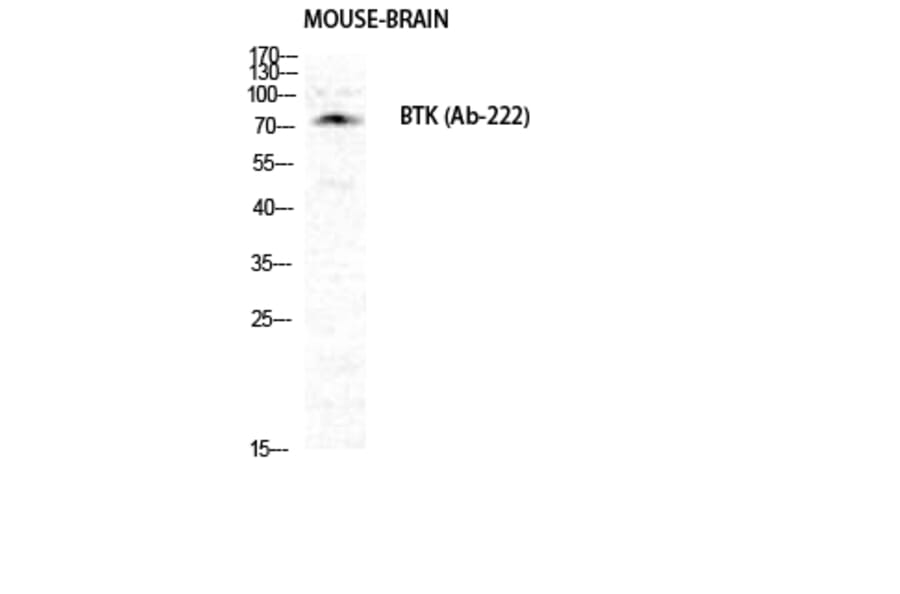 Western Blot - Anti-BTK Antibody (B0054) - Antibodies.com