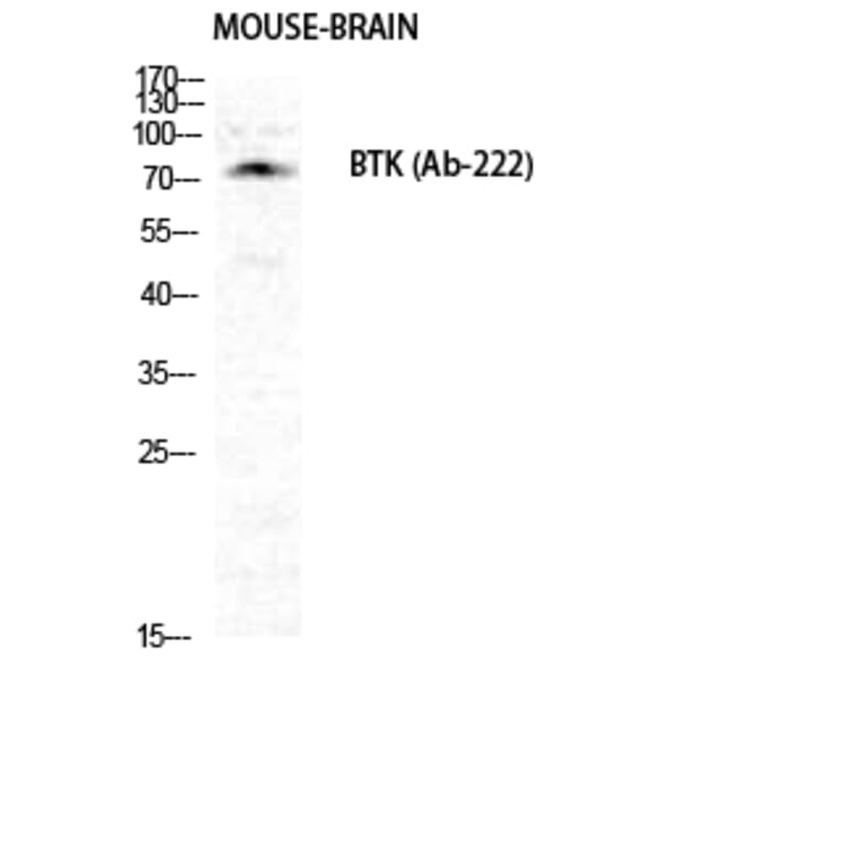 Western Blot - Anti-BTK Antibody (B0054) - Antibodies.com