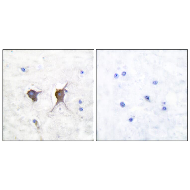 Immunohistochemistry - Anti-Bax Antibody (C0132) - Antibodies.com