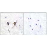 Immunohistochemistry - Anti-Bax Antibody (C0132) - Antibodies.com