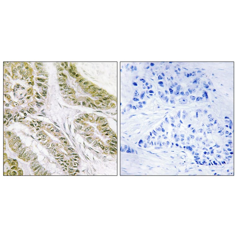 Immunohistochemistry - Anti-BAX Antibody (C13029) - Antibodies.com