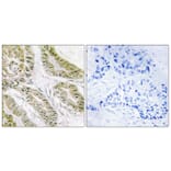 Immunohistochemistry - Anti-BAX Antibody (C13029) - Antibodies.com