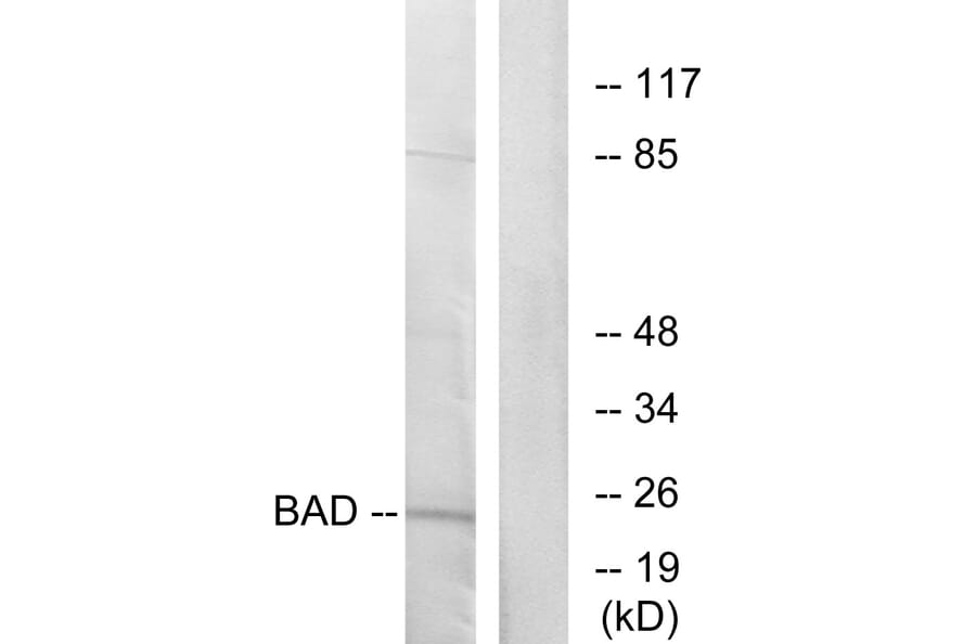 Western Blot - Anti-BAD Antibody (B7019) - Antibodies.com