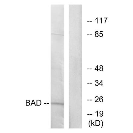Western Blot - Anti-BAD Antibody (B7019) - Antibodies.com