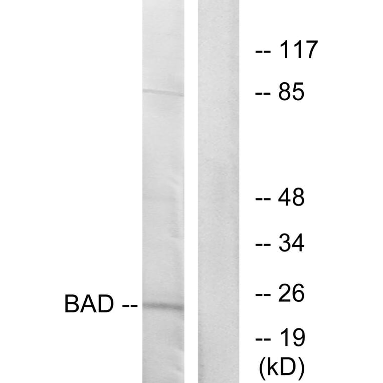 Western Blot - Anti-BAD Antibody (B7019) - Antibodies.com