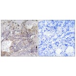 Immunohistochemistry - Anti-BAD Antibody (B7019) - Antibodies.com