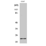 Western Blot - Anti-BAD Antibody (B7019) - Antibodies.com