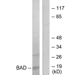 Western Blot - Anti-BAD Antibody (B7021) - Antibodies.com