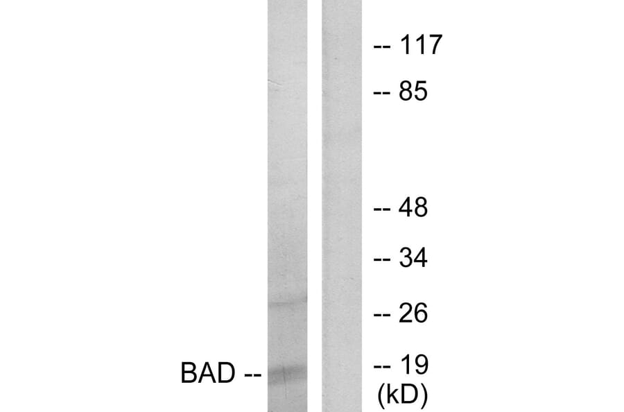 Western Blot - Anti-BAD Antibody (B7021) - Antibodies.com