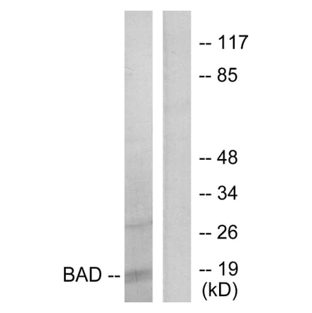 Western Blot - Anti-BAD Antibody (B7021) - Antibodies.com