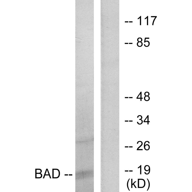 Western Blot - Anti-BAD Antibody (B7021) - Antibodies.com