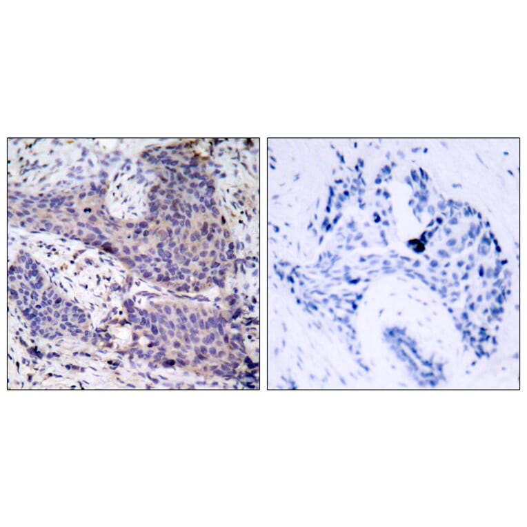 Immunohistochemistry - Anti-BAD Antibody (B7021) - Antibodies.com