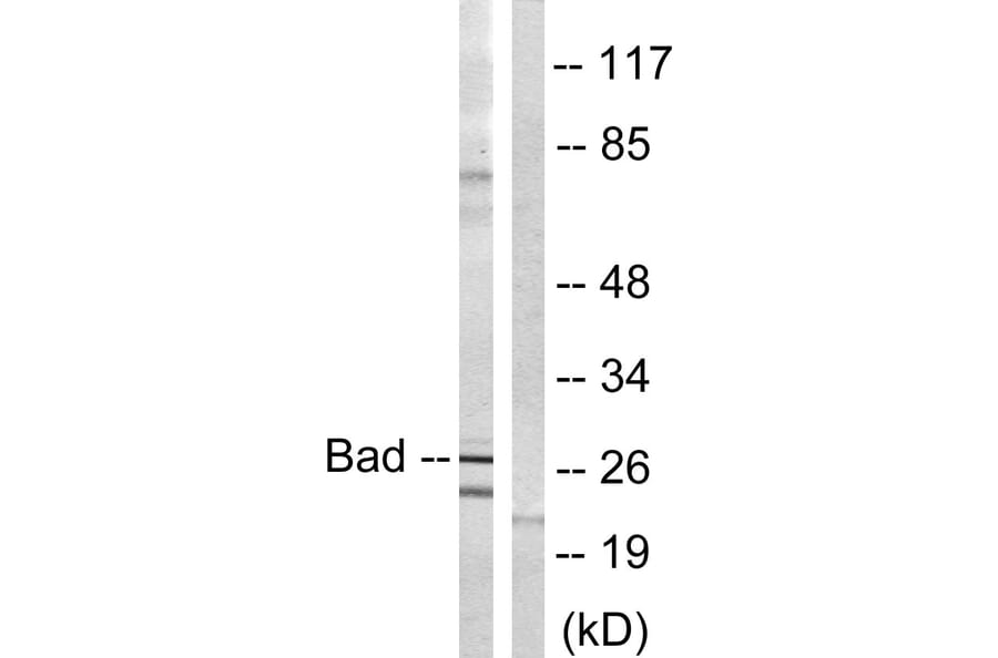 Western Blot - Anti-BAD Antibody (B0822) - Antibodies.com