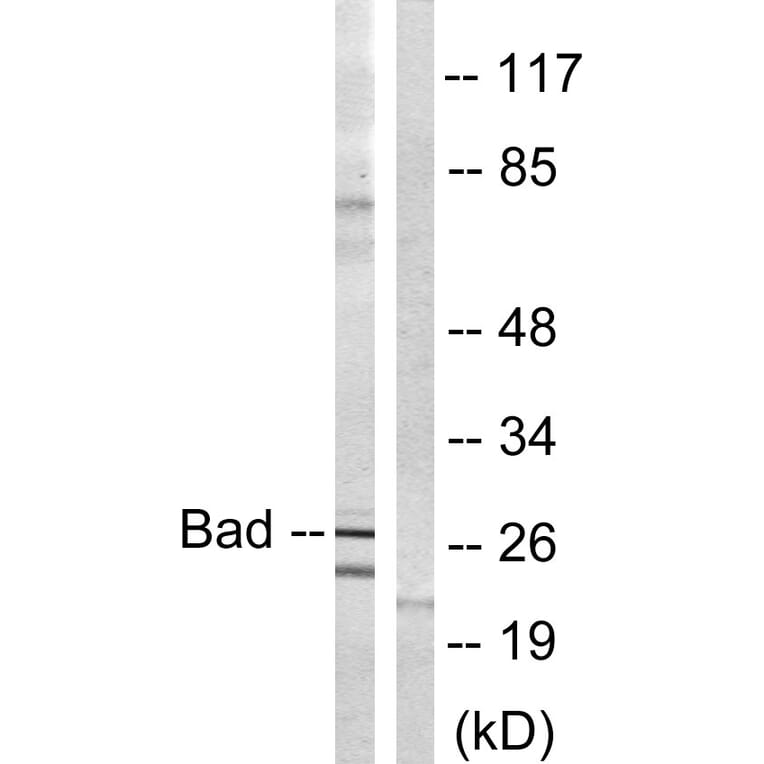 Western Blot - Anti-BAD Antibody (B0822) - Antibodies.com