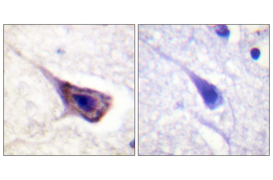 Immunohistochemistry - Anti-BAD Antibody (B0822) - Antibodies.com